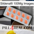 Sildenafil 100Mg Images 26